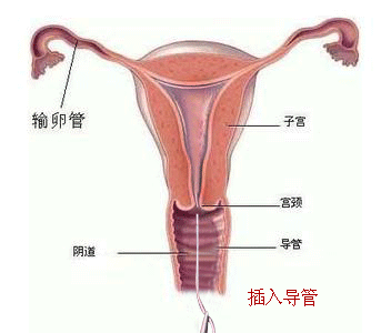 造影
